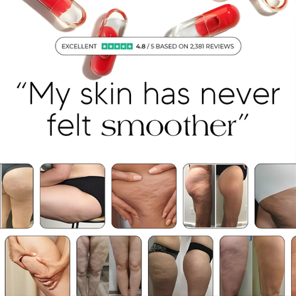 Smooth Skin Anti-Cellulite & Lipedema Capsules
